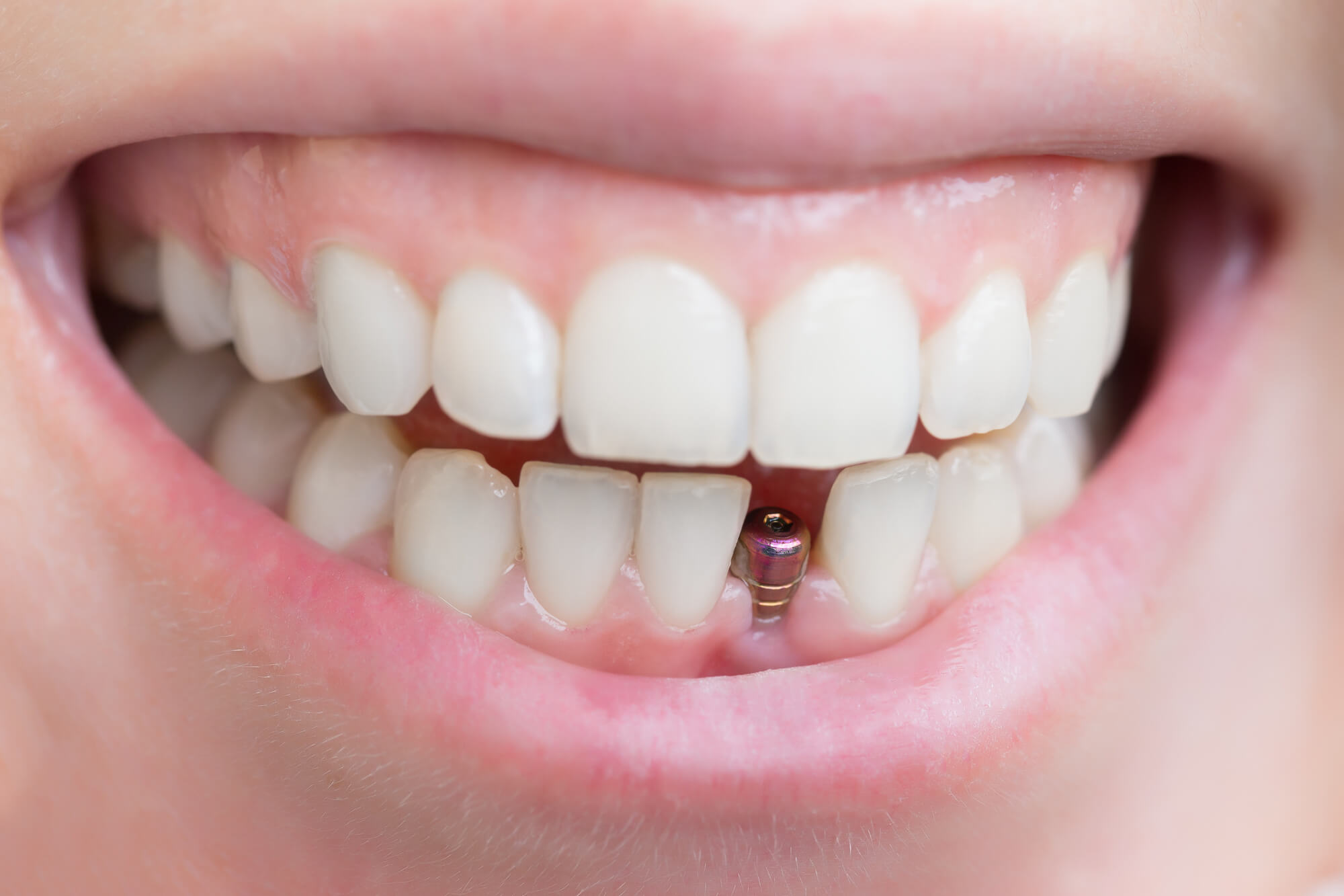 Dr Rajnees Dental