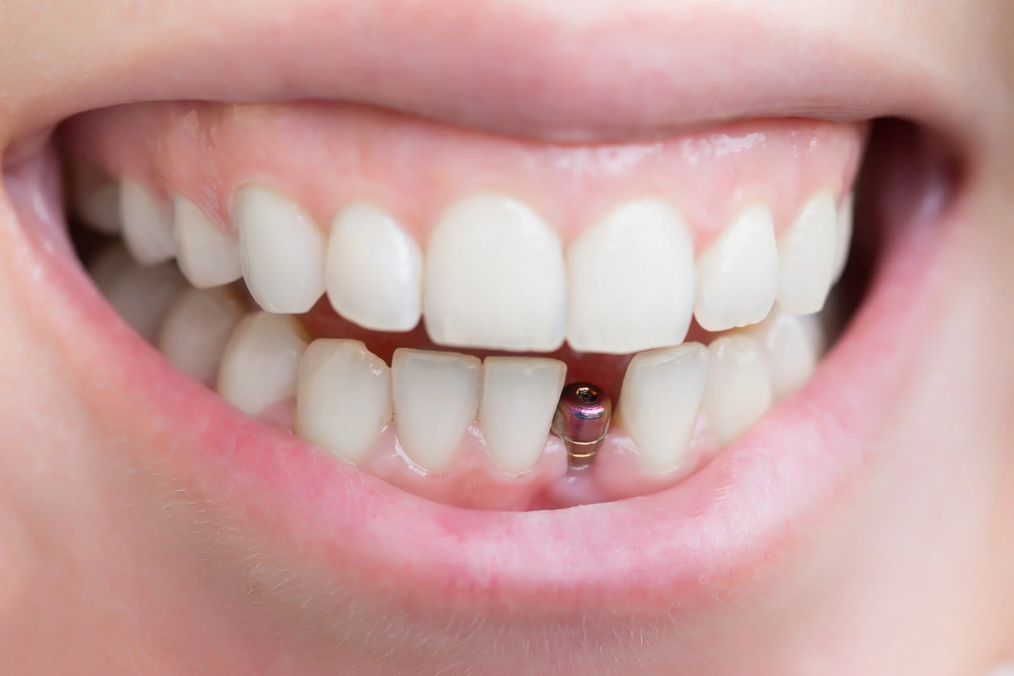 Dr Rajnees Dental