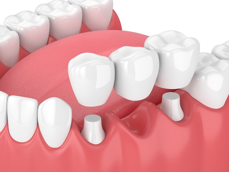 Dr Rajnees Dental