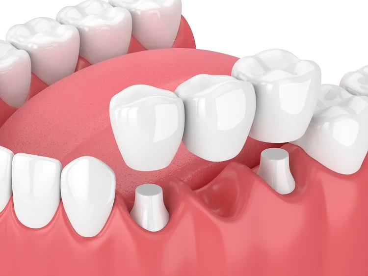 Dr Rajnees Dental