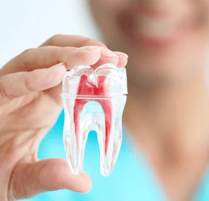 Root Canal Treatment