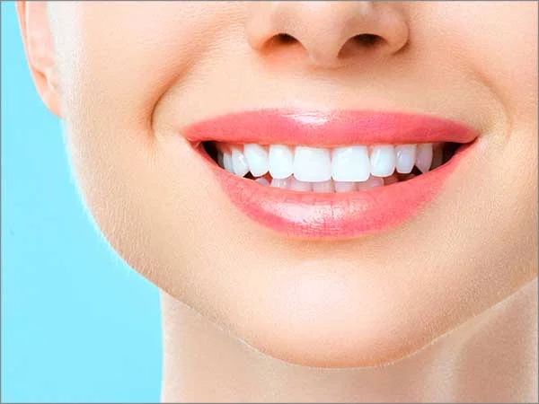Smile Designing